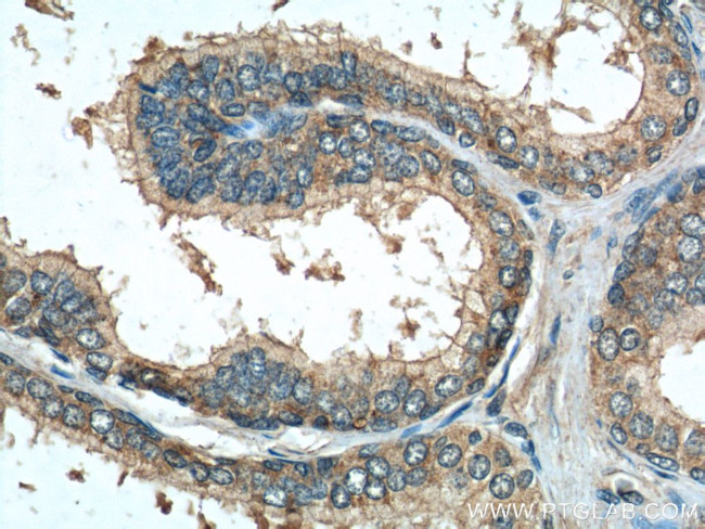 DNASE2B Antibody in Immunohistochemistry (Paraffin) (IHC (P))