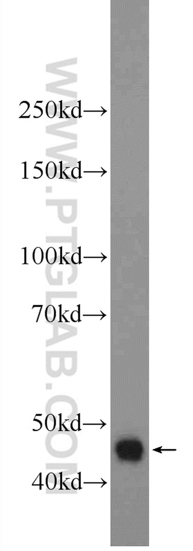 DNASE2B Antibody in Western Blot (WB)