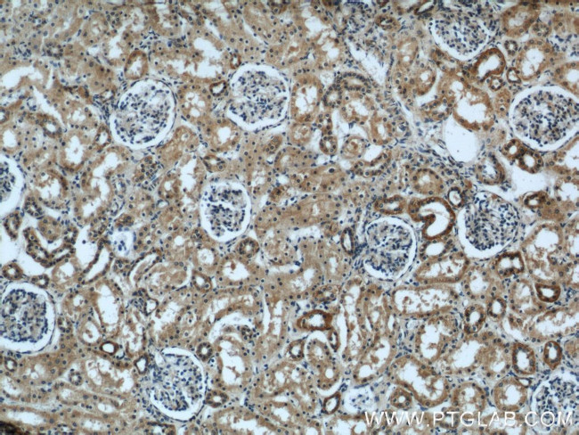 EYA1 Antibody in Immunohistochemistry (Paraffin) (IHC (P))