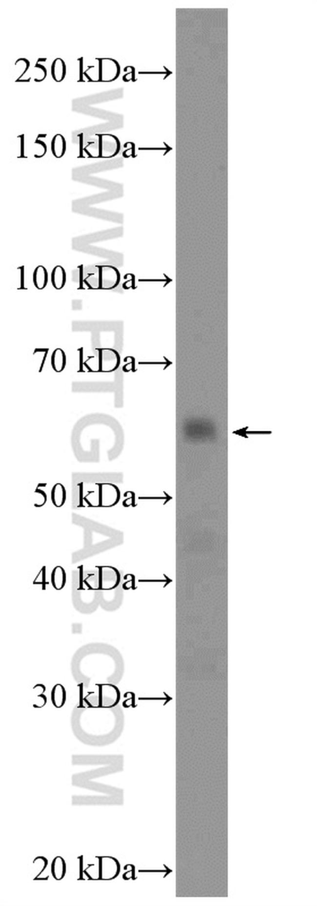 EYA1 Antibody in Western Blot (WB)