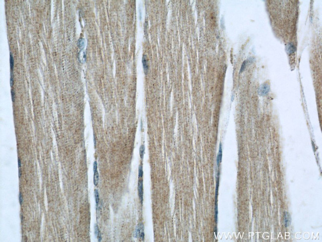 C14orf39 Antibody in Immunohistochemistry (Paraffin) (IHC (P))