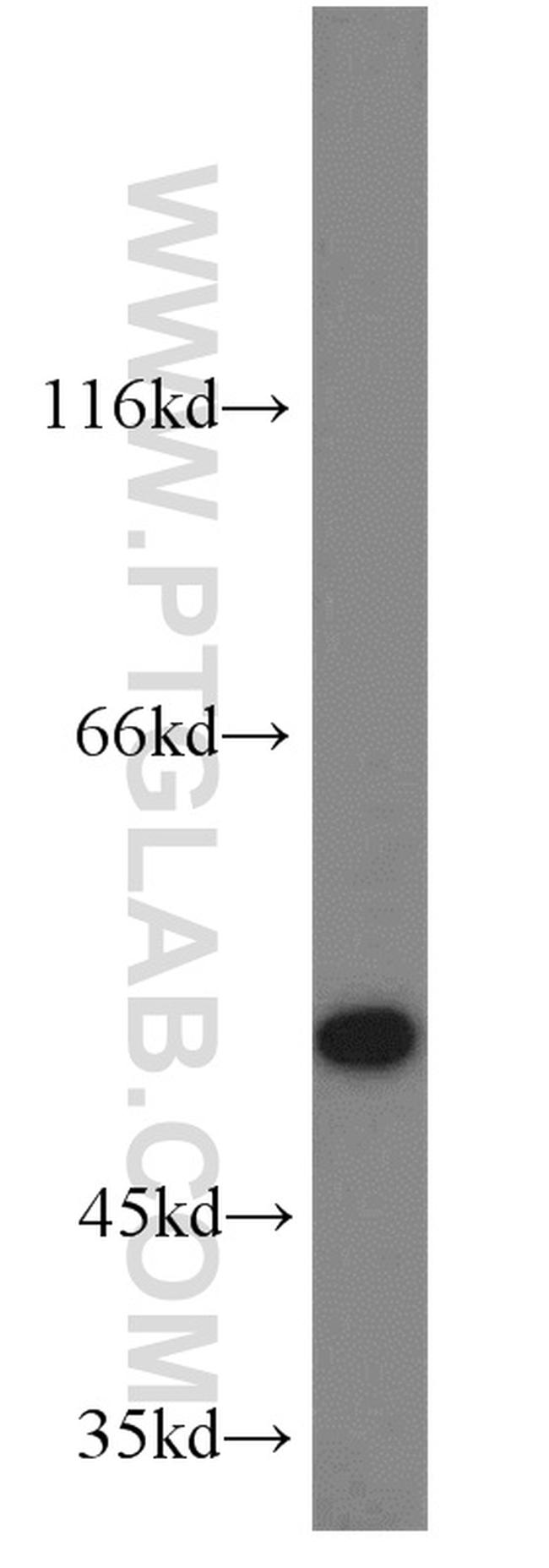 C14orf39 Antibody in Western Blot (WB)