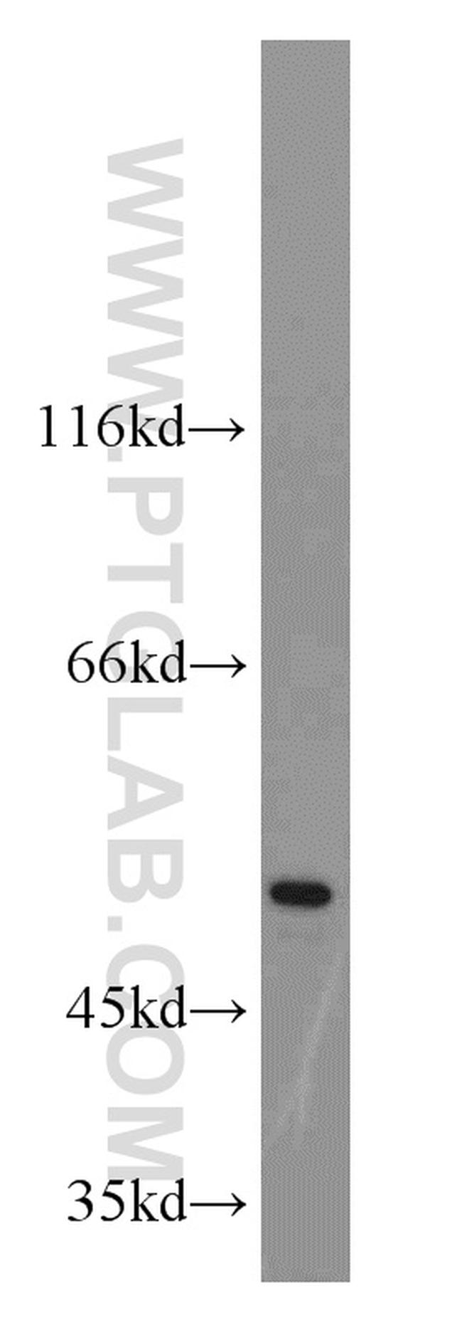 C14orf39 Antibody in Western Blot (WB)