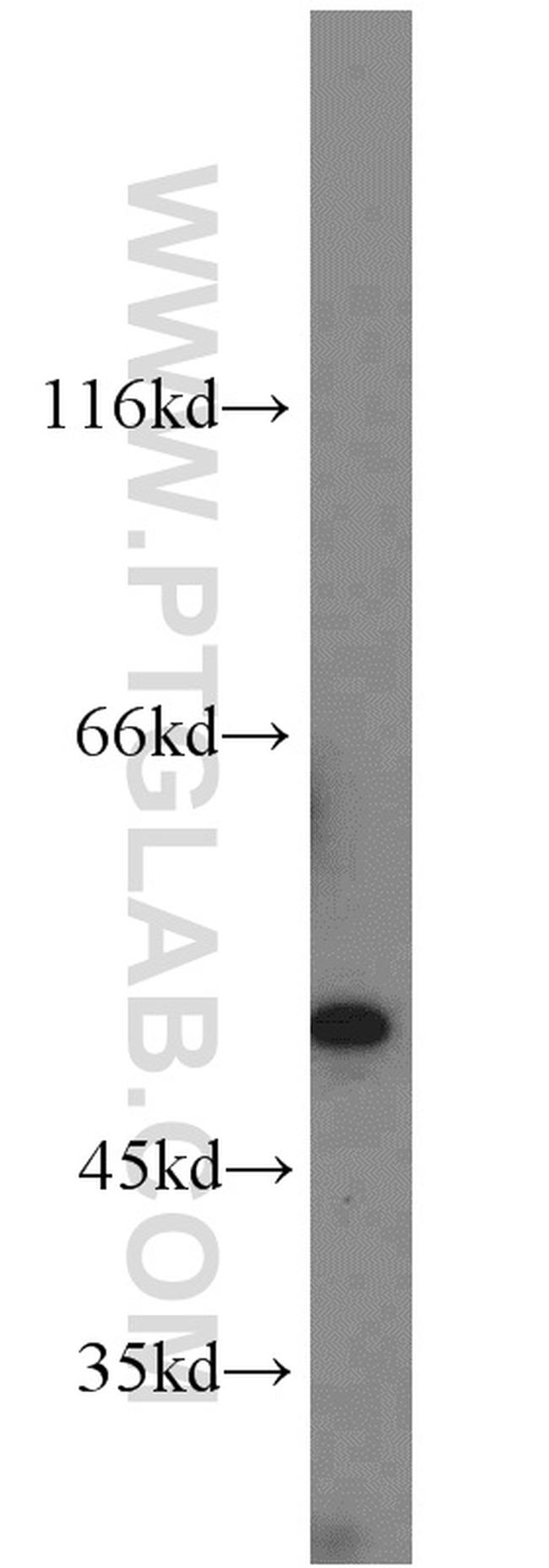 C14orf39 Antibody in Western Blot (WB)