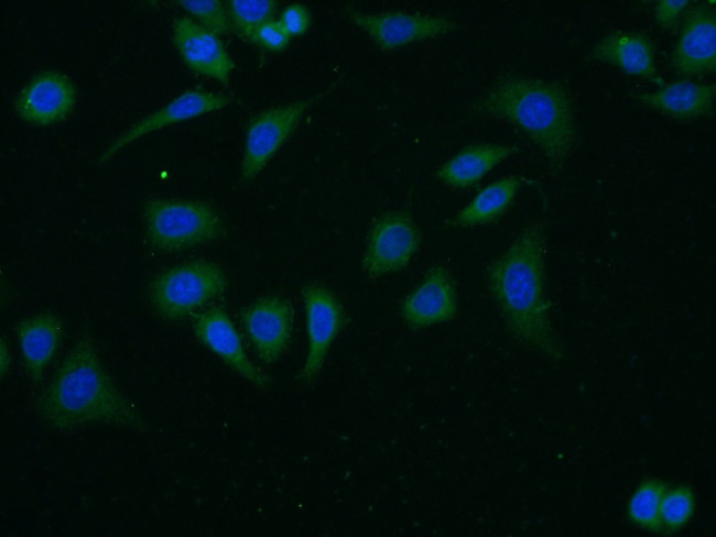 FSHR Antibody in Immunocytochemistry (ICC/IF)