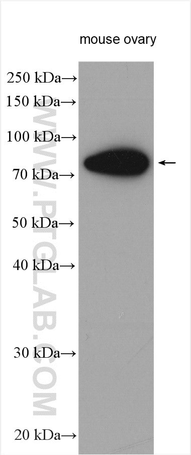 FSHR Antibody in Western Blot (WB)