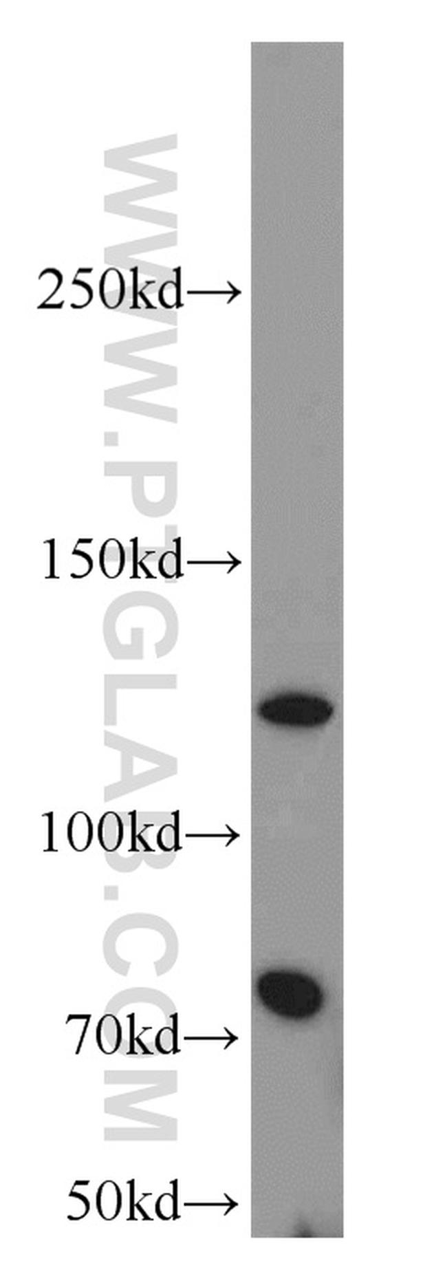 FSHR Antibody in Western Blot (WB)