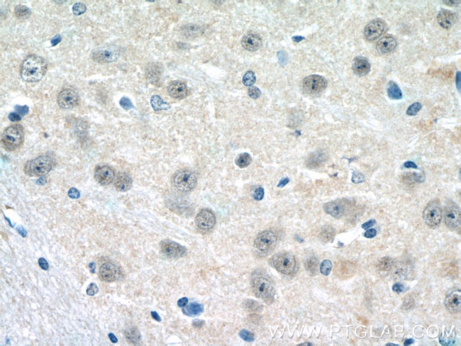 HES5 Antibody in Immunohistochemistry (Paraffin) (IHC (P))