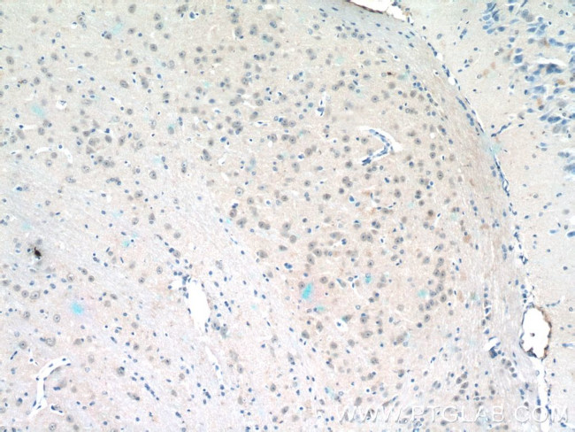 HES5 Antibody in Immunohistochemistry (Paraffin) (IHC (P))