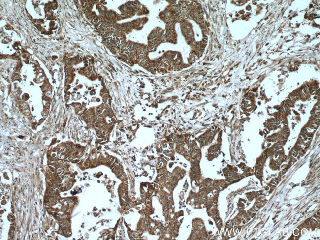 A4GNT Antibody in Immunohistochemistry (Paraffin) (IHC (P))