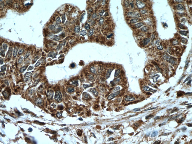 A4GNT Antibody in Immunohistochemistry (Paraffin) (IHC (P))