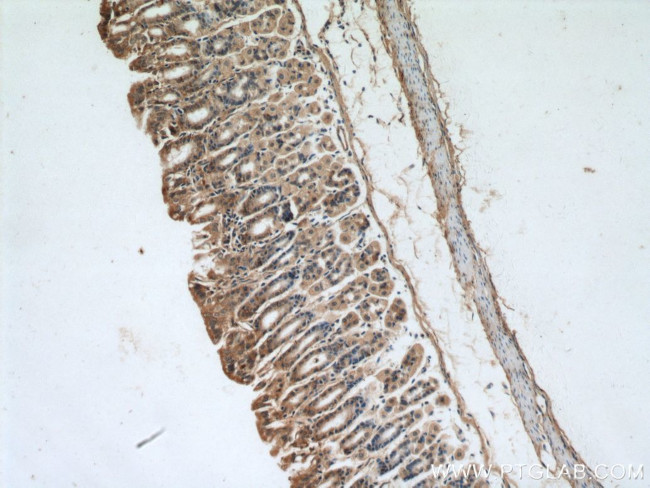 A4GNT Antibody in Immunohistochemistry (Paraffin) (IHC (P))