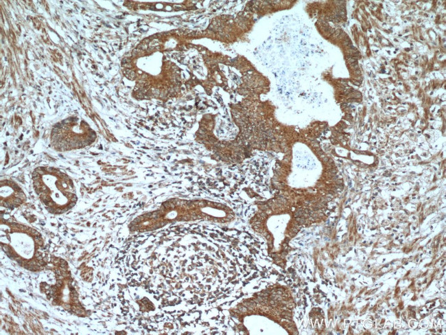 A4GNT Antibody in Immunohistochemistry (Paraffin) (IHC (P))