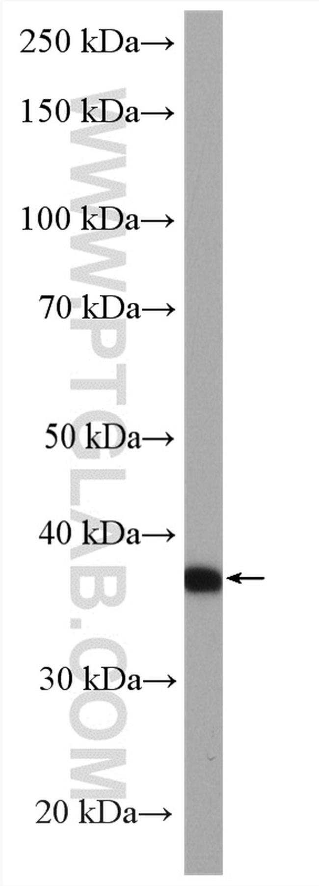 A4GNT Antibody in Western Blot (WB)