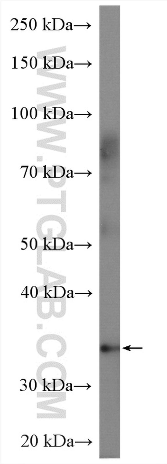 A4GNT Antibody in Western Blot (WB)