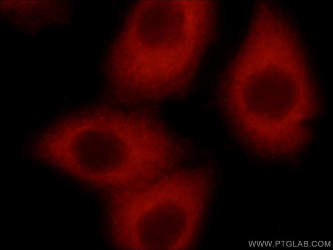 STARS/ABRA Antibody in Immunocytochemistry (ICC/IF)