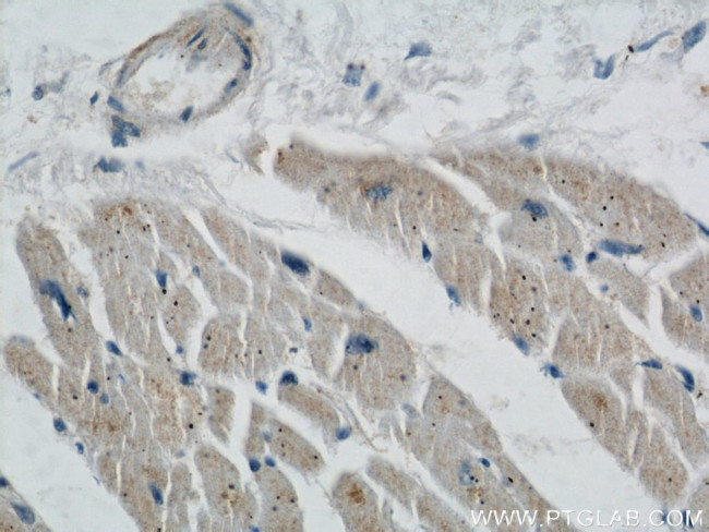 STARS/ABRA Antibody in Immunohistochemistry (Paraffin) (IHC (P))