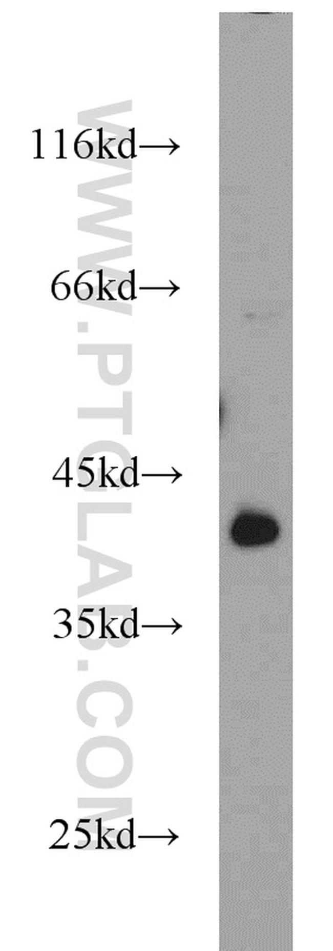 STARS/ABRA Antibody in Western Blot (WB)