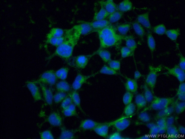 RBP1 Antibody in Immunocytochemistry (ICC/IF)