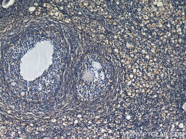 RBP1 Antibody in Immunohistochemistry (Paraffin) (IHC (P))