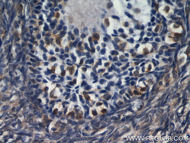 RBP1 Antibody in Immunohistochemistry (Paraffin) (IHC (P))