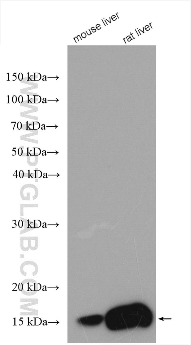 RBP1 Antibody in Western Blot (WB)