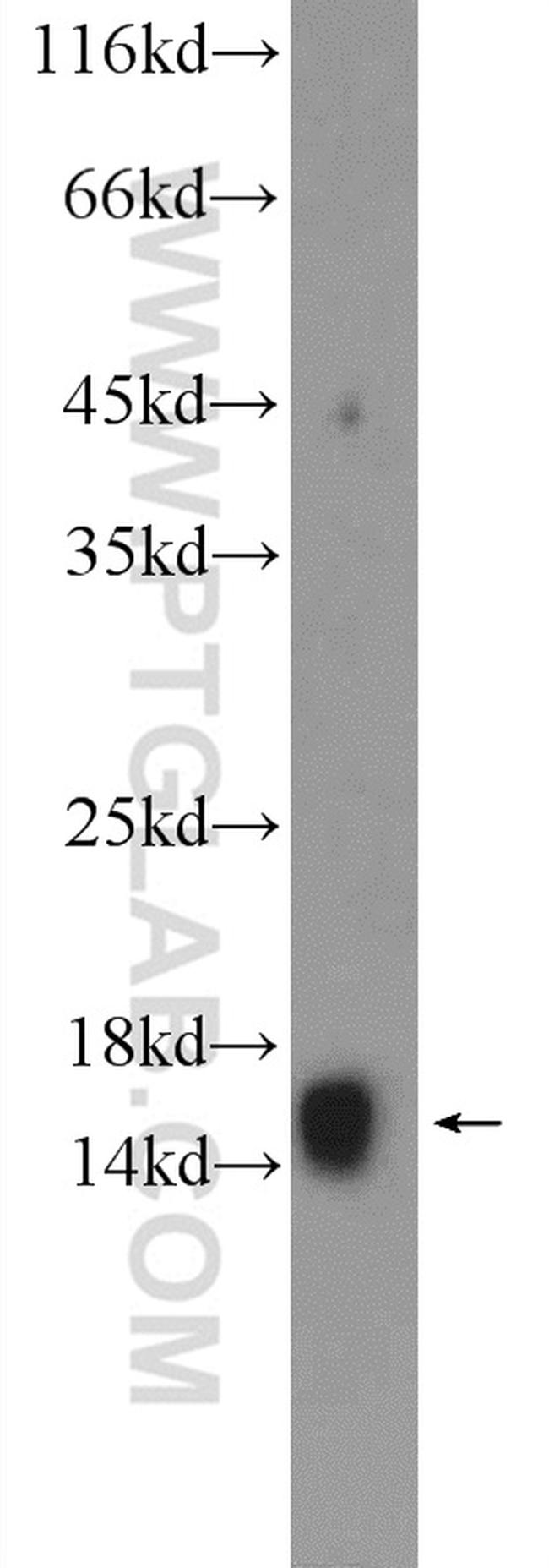 RBP1 Antibody in Western Blot (WB)