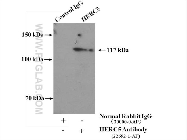 HERC5 Antibody in Immunoprecipitation (IP)