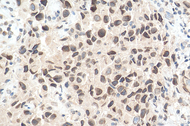 WHSC1 Antibody in Immunohistochemistry (Paraffin) (IHC (P))