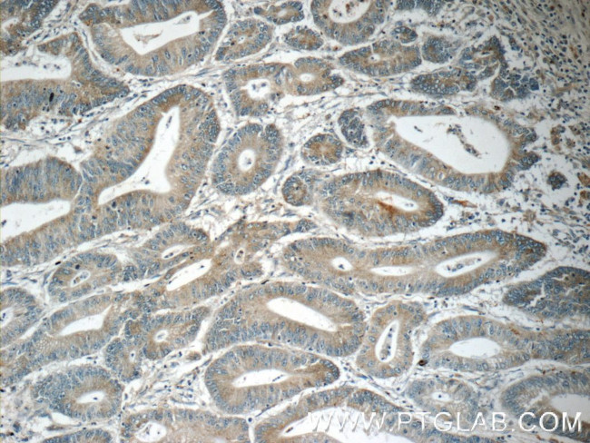 ARK5 Antibody in Immunohistochemistry (Paraffin) (IHC (P))