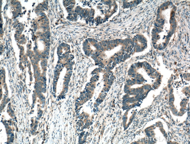 ARK5 Antibody in Immunohistochemistry (Paraffin) (IHC (P))