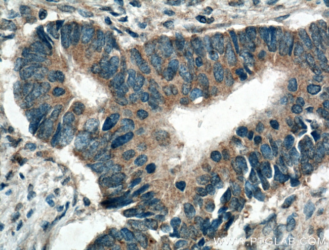 ARK5 Antibody in Immunohistochemistry (Paraffin) (IHC (P))