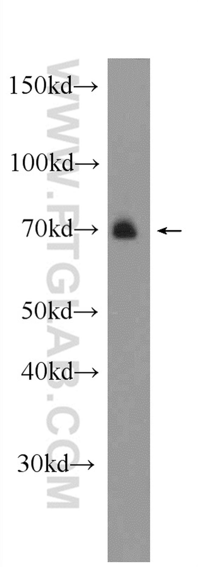 ARK5 Antibody in Western Blot (WB)