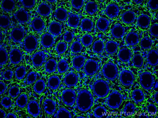 Collagen Type III (N-terminal) Antibody in Immunohistochemistry (PFA fixed) (IHC (PFA))