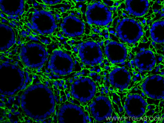 Collagen Type III (N-terminal) Antibody in Immunohistochemistry (PFA fixed) (IHC (PFA))