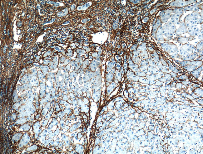 Collagen Type III (N-terminal) Antibody in Immunohistochemistry (Paraffin) (IHC (P))