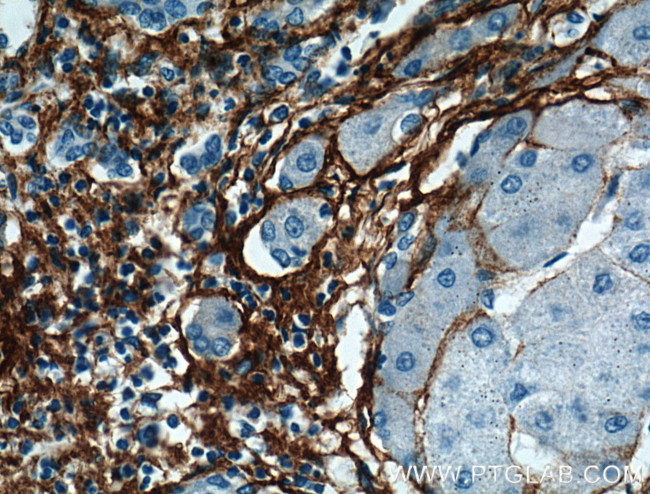 Collagen Type III (N-terminal) Antibody in Immunohistochemistry (Paraffin) (IHC (P))
