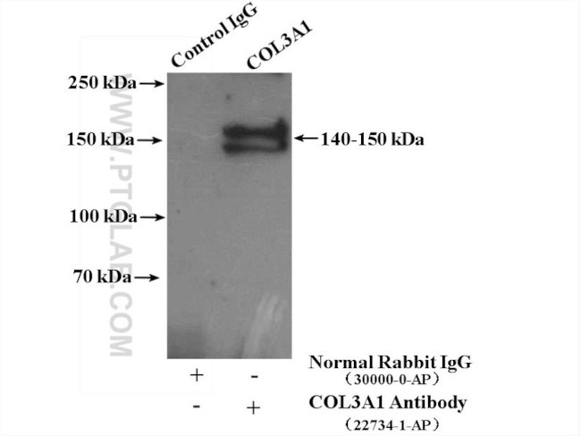 Collagen Type III (N-terminal) Antibody in Immunoprecipitation (IP)