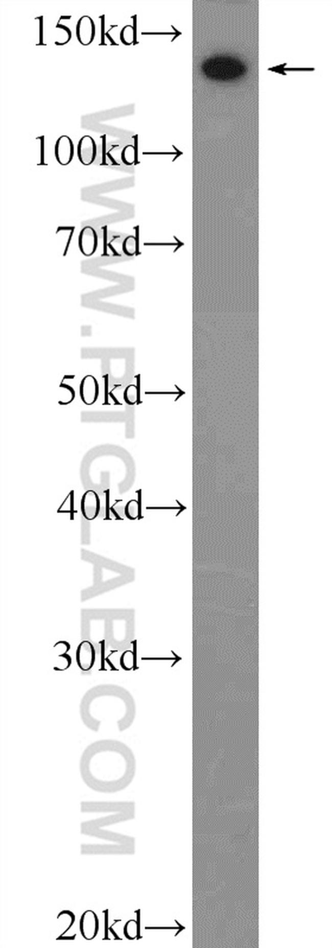 Collagen Type III (N-terminal) Antibody in Western Blot (WB)