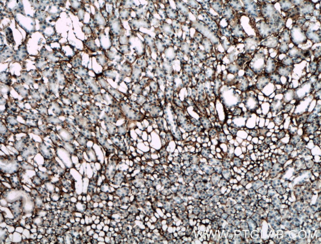 Collagen Type III (N-terminal) Antibody in Immunohistochemistry (Paraffin) (IHC (P))