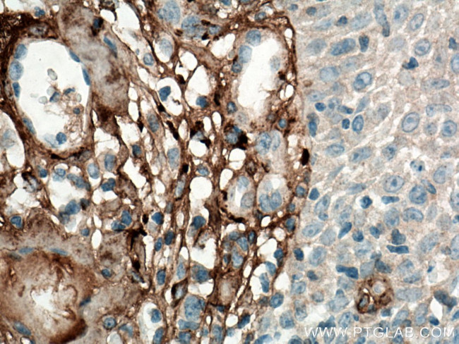 Collagen Type III (N-terminal) Antibody in Immunohistochemistry (Paraffin) (IHC (P))