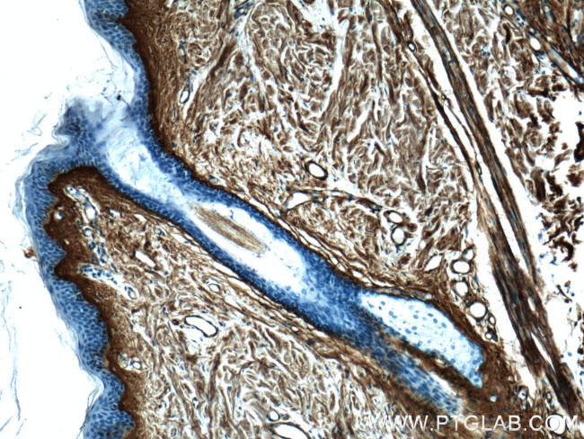 Collagen Type III (N-terminal) Antibody in Immunohistochemistry (Paraffin) (IHC (P))