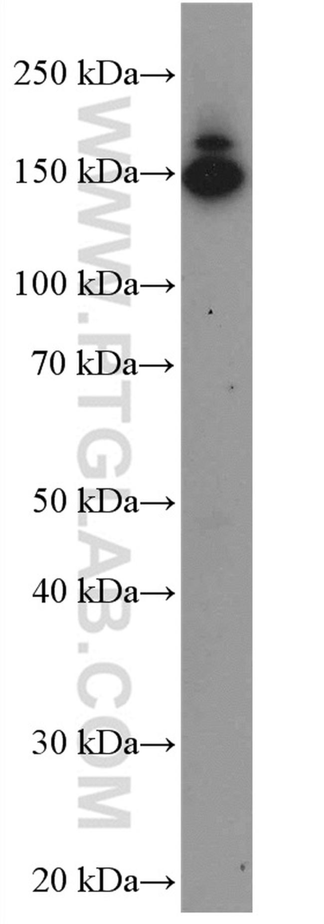 Collagen Type III (N-terminal) Antibody in Western Blot (WB)