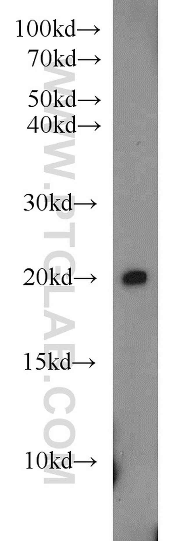 MIXL1 Antibody in Western Blot (WB)