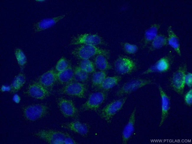 LIFR Antibody in Immunocytochemistry (ICC/IF)