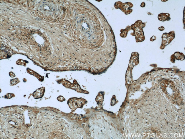 LIFR Antibody in Immunohistochemistry (Paraffin) (IHC (P))