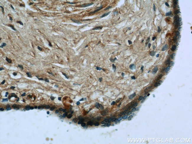 LIFR Antibody in Immunohistochemistry (Paraffin) (IHC (P))