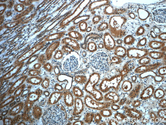 LIFR Antibody in Immunohistochemistry (Paraffin) (IHC (P))