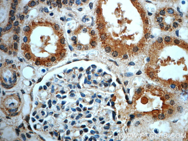 LIFR Antibody in Immunohistochemistry (Paraffin) (IHC (P))