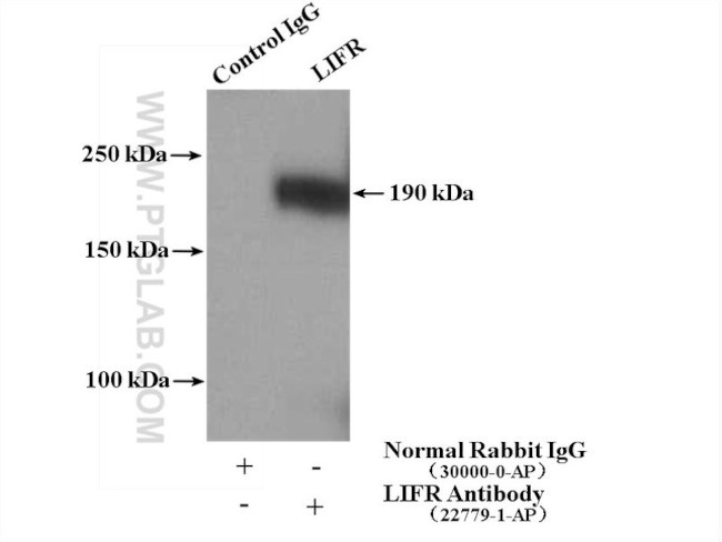 LIFR Antibody in Immunoprecipitation (IP)